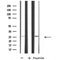 Western blot analysis of RAB26 expression in various lysates