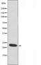 DF4400 staining Hela cells by IF/ICC. The sample were fixed with PFA and permeabilized in 0.1% Triton X-100,then blocked in 10% serum for 45 minutes at 25¡ãC. The primary antibody was diluted at 1/200 and incubated with the sample for 1 hour at 37¡ãC. An  Alexa Fluor 594 conjugated goat anti-rabbit IgG (H+L) antibody(Cat.# S0006), diluted at 1/600, was used as secondary antibod