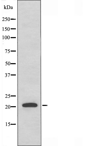 DF4401 staining HeLa cells by IF/ICC. The sample were fixed with PFA and permeabilized in 0.1% Triton X-100,then blocked in 10% serum for 45 minutes at 25¡ãC. The primary antibody was diluted at 1/200 and incubated with the sample for 1 hour at 37¡ãC. An  Alexa Fluor 594 conjugated goat anti-rabbit IgG (H+L) antibody(Cat.# S0006), diluted at 1/600, was used as secondary antibod