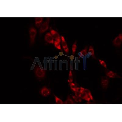 Western blot analysis of extracts from HepG2, using RAB33A Antibody. Lane 1 was treated with the blocking peptide.