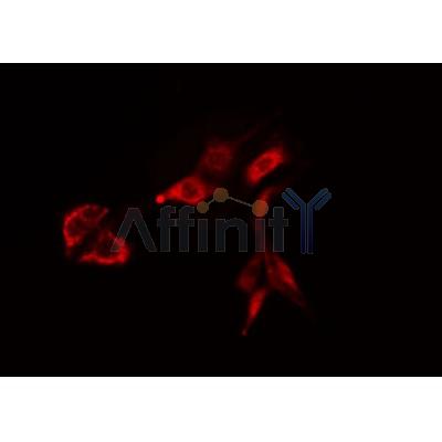 DF4404 staining HepG2 by IF/ICC. The sample were fixed with PFA and permeabilized in 0.1% Triton X-100,then blocked in 10% serum for 45 minutes at 25¡ãC. The primary antibody was diluted at 1/200 and incubated with the sample for 1 hour at 37¡ãC. An  Alexa Fluor 594 conjugated goat anti-rabbit IgG (H+L) Ab, diluted at 1/600, was used as the secondary antibod