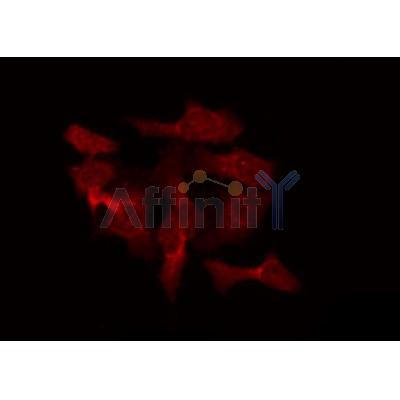 Western blot analysis of extracts from mouse spleen, rat spleen and Hela, using RAB40B Antibody.
