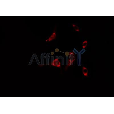 Western blot analysis of extracts from Hela, using RAB6A Antibody. Lane 1 was treated with the blocking peptide.