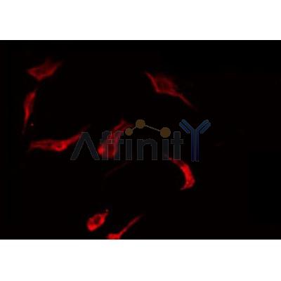 Western blot analysis of extracts from mouse brain, using RAB7L1 Antibody.