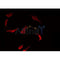 Western blot analysis of extracts from mouse brain, using RAB7L1 Antibody.