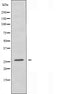 DF4411 staining Hela cells by IF/ICC. The sample were fixed with PFA and permeabilized in 0.1% Triton X-100,then blocked in 10% serum for 45 minutes at 25¡ãC. The primary antibody was diluted at 1/200 and incubated with the sample for 1 hour at 37¡ãC. An  Alexa Fluor 594 conjugated goat anti-rabbit IgG (H+L) antibody(Cat.# S0006), diluted at 1/600, was used as secondary antibod