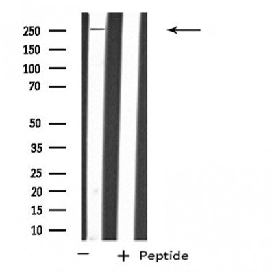 Western blot analysis of extracts from HUVEC, using PTPRZ1 Antibody. Lane 1 was treated with the blocking peptide.