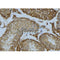 Western blot analysis of extracts from Hela, using RGS1 Antibody. Lane 1 was treated with the antigen-specific peptide.