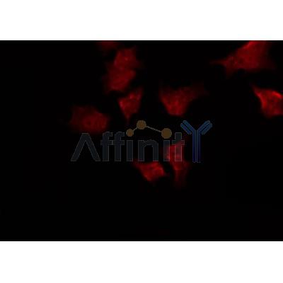 DF4414 staining HepG2 by IF/ICC. The sample were fixed with PFA and permeabilized in 0.1% Triton X-100,then blocked in 10% serum for 45 minutes at 25¡ãC. The primary antibody was diluted at 1/200 and incubated with the sample for 1 hour at 37¡ãC. An  Alexa Fluor 594 conjugated goat anti-rabbit IgG (H+L) Ab, diluted at 1/600, was used as the secondary antibod