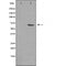 DF4416 staining NIH-3T3 cells by IF/ICC. The sample were fixed with PFA and permeabilized in 0.1% Triton X-100,then blocked in 10% serum for 45 minutes at 25¡ãC. The primary antibody was diluted at 1/200 and incubated with the sample for 1 hour at 37¡ãC. An  Alexa Fluor 594 conjugated goat anti-rabbit IgG (H+L) antibody(Cat.# S0006), diluted at 1/600, was used as secondary antibod