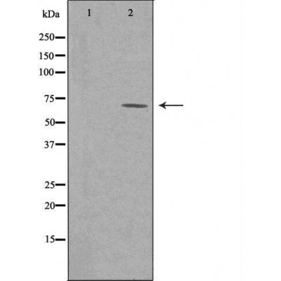 DF4418 staining Hela cells by IF/ICC. The sample were fixed with PFA and permeabilized in 0.1% Triton X-100,then blocked in 10% serum for 45 minutes at 25¡ãC. The primary antibody was diluted at 1/200 and incubated with the sample for 1 hour at 37¡ãC. An  Alexa Fluor 594 conjugated goat anti-rabbit IgG (H+L) antibody(Cat.# S0006), diluted at 1/600, was used as secondary antibod
