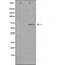 DF4418 staining Hela cells by IF/ICC. The sample were fixed with PFA and permeabilized in 0.1% Triton X-100,then blocked in 10% serum for 45 minutes at 25¡ãC. The primary antibody was diluted at 1/200 and incubated with the sample for 1 hour at 37¡ãC. An  Alexa Fluor 594 conjugated goat anti-rabbit IgG (H+L) antibody(Cat.# S0006), diluted at 1/600, was used as secondary antibod