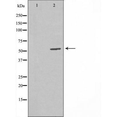 DF4423 staining HepG2 by IF/ICC. The sample were fixed with PFA and permeabilized in 0.1% Triton X-100,then blocked in 10% serum for 45 minutes at 25¡ãC. The primary antibody was diluted at 1/200 and incubated with the sample for 1 hour at 37¡ãC. An  Alexa Fluor 594 conjugated goat anti-rabbit IgG (H+L) Ab, diluted at 1/600, was used as the secondary antibod
