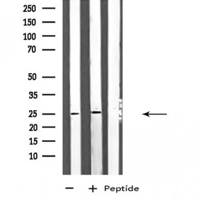 DF4424 staining A549 cells by IF/ICC. The sample were fixed with PFA and permeabilized in 0.1% Triton X-100,then blocked in 10% serum for 45 minutes at 25¡ãC. The primary antibody was diluted at 1/200 and incubated with the sample for 1 hour at 37¡ãC. An  Alexa Fluor 594 conjugated goat anti-rabbit IgG (H+L) antibody(Cat.# S0006), diluted at 1/600, was used as secondary antibod