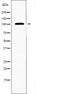 DF4426 staining LOVO by IF/ICC. The sample were fixed with PFA and permeabilized in 0.1% Triton X-100,then blocked in 10% serum for 45 minutes at 25¡ãC. The primary antibody was diluted at 1/200 and incubated with the sample for 1 hour at 37¡ãC. An  Alexa Fluor 594 conjugated goat anti-rabbit IgG (H+L) Ab, diluted at 1/600, was used as the secondary antibod