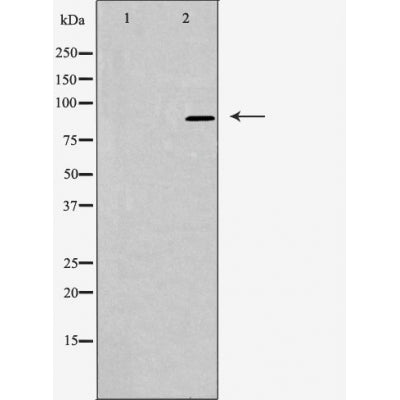 DF4428 staining LOVO cells by IF/ICC. The sample were fixed with PFA and permeabilized in 0.1% Triton X-100,then blocked in 10% serum for 45 minutes at 25¡ãC. The primary antibody was diluted at 1/200 and incubated with the sample for 1 hour at 37¡ãC. An  Alexa Fluor 594 conjugated goat anti-rabbit IgG (H+L) antibody(Cat.# S0006), diluted at 1/600, was used as secondary antibod