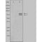 Western blot analysis of extracts from rat muscle cells using ARHGEF7 antibody.The lane on the left is treated with the antigen-specific peptide.