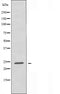 DF4439 staining COLO205 cells by IF/ICC. The sample were fixed with PFA and permeabilized in 0.1% Triton X-100,then blocked in 10% serum for 45 minutes at 25¡ãC. The primary antibody was diluted at 1/200 and incubated with the sample for 1 hour at 37¡ãC. An  Alexa Fluor 594 conjugated goat anti-rabbit IgG (H+L) antibody(Cat.# S0006), diluted at 1/600, was used as secondary antibod