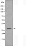 DF4440 staining  HepG2 cells by IF/ICC. The sample were fixed with PFA and permeabilized in 0.1% Triton X-100,then blocked in 10% serum for 45 minutes at 25¡ãC. The primary antibody was diluted at 1/200 and incubated with the sample for 1 hour at 37¡ãC. An  Alexa Fluor 594 conjugated goat anti-rabbit IgG (H+L) antibody(Cat.# S0006), diluted at 1/600, was used as secondary antibod