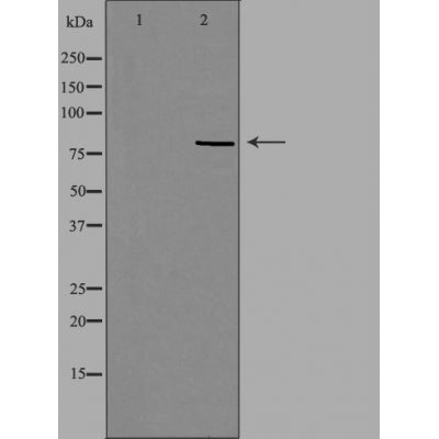 DF4443 staining HepG2 by IF/ICC. The sample were fixed with PFA and permeabilized in 0.1% Triton X-100,then blocked in 10% serum for 45 minutes at 25¡ãC. The primary antibody was diluted at 1/200 and incubated with the sample for 1 hour at 37¡ãC. An  Alexa Fluor 594 conjugated goat anti-rabbit IgG (H+L) Ab, diluted at 1/600, was used as the secondary antibod