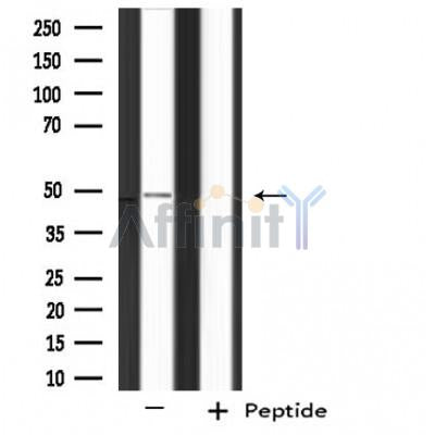 DF4446 staining HT29 cells by IF/ICC. The sample were fixed with PFA and permeabilized in 0.1% Triton X-100,then blocked in 10% serum for 45 minutes at 25¡ãC. The primary antibody was diluted at 1/200 and incubated with the sample for 1 hour at 37¡ãC. An  Alexa Fluor 594 conjugated goat anti-rabbit IgG (H+L) antibody(Cat.# S0006), diluted at 1/600, was used as secondary antibod