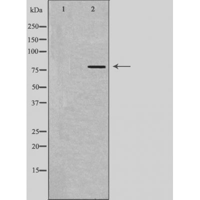 DF4448 staining  HeLa cells by IF/ICC. The sample were fixed with PFA and permeabilized in 0.1% Triton X-100,then blocked in 10% serum for 45 minutes at 25¡ãC. The primary antibody was diluted at 1/200 and incubated with the sample for 1 hour at 37¡ãC. An  Alexa Fluor 594 conjugated goat anti-rabbit IgG (H+L) antibody(Cat.# S0006), diluted at 1/600, was used as secondary antibod