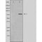 DF4448 staining  HeLa cells by IF/ICC. The sample were fixed with PFA and permeabilized in 0.1% Triton X-100,then blocked in 10% serum for 45 minutes at 25¡ãC. The primary antibody was diluted at 1/200 and incubated with the sample for 1 hour at 37¡ãC. An  Alexa Fluor 594 conjugated goat anti-rabbit IgG (H+L) antibody(Cat.# S0006), diluted at 1/600, was used as secondary antibod