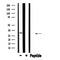 DF4451 staining HeLa by IF/ICC. The sample were fixed with PFA and permeabilized in 0.1% Triton X-100,then blocked in 10% serum for 45 minutes at 25¡ãC. The primary antibody was diluted at 1/200 and incubated with the sample for 1 hour at 37¡ãC. An  Alexa Fluor 594 conjugated goat anti-rabbit IgG (H+L) Ab, diluted at 1/600, was used as the secondary antibod