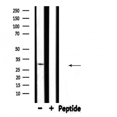 DF4451 staining HeLa by IF/ICC. The sample were fixed with PFA and permeabilized in 0.1% Triton X-100,then blocked in 10% serum for 45 minutes at 25¡ãC. The primary antibody was diluted at 1/200 and incubated with the sample for 1 hour at 37¡ãC. An  Alexa Fluor 594 conjugated goat anti-rabbit IgG (H+L) Ab, diluted at 1/600, was used as the secondary antibod