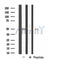 DF4468 staining HepG2 by IF/ICC. The sample were fixed with PFA and permeabilized in 0.1% Triton X-100,then blocked in 10% serum for 45 minutes at 25¡ãC. The primary antibody was diluted at 1/200 and incubated with the sample for 1 hour at 37¡ãC. An  Alexa Fluor 594 conjugated goat anti-rabbit IgG (H+L) Ab, diluted at 1/600, was used as the secondary antibod