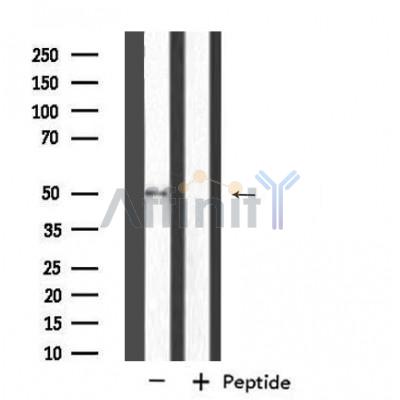 DF4468 staining HepG2 by IF/ICC. The sample were fixed with PFA and permeabilized in 0.1% Triton X-100,then blocked in 10% serum for 45 minutes at 25¡ãC. The primary antibody was diluted at 1/200 and incubated with the sample for 1 hour at 37¡ãC. An  Alexa Fluor 594 conjugated goat anti-rabbit IgG (H+L) Ab, diluted at 1/600, was used as the secondary antibod