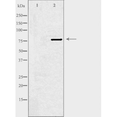 DF4470 staining HeLa cells by IF/ICC. The sample were fixed with PFA and permeabilized in 0.1% Triton X-100,then blocked in 10% serum for 45 minutes at 25¡ãC. The primary antibody was diluted at 1/200 and incubated with the sample for 1 hour at 37¡ãC. An  Alexa Fluor 594 conjugated goat anti-rabbit IgG (H+L) antibody(Cat.# S0006), diluted at 1/600, was used as secondary antibod