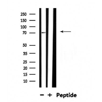 DF4471 staining  HepG2 cells by IF/ICC. The sample were fixed with PFA and permeabilized in 0.1% Triton X-100,then blocked in 10% serum for 45 minutes at 25¡ãC. The primary antibody was diluted at 1/200 and incubated with the sample for 1 hour at 37¡ãC. An  Alexa Fluor 594 conjugated goat anti-rabbit IgG (H+L) antibody(Cat.# S0006), diluted at 1/600, was used as secondary antibod