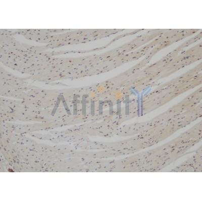 DF4477 at 1/100 staining Mouse heart tissue by IHC-P. The sample was formaldehyde fixed and a heat mediated antigen retrieval step in citrate buffer was performed. The sample was then blocked and incubated with the antibody for 1.5 hours at 22¡ãC. An HRP conjugated goat anti-rabbit antibody was used as the secondary