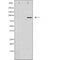 DF4478 staining  COLO205 cells by IF/ICC. The sample were fixed with PFA and permeabilized in 0.1% Triton X-100,then blocked in 10% serum for 45 minutes at 25¡ãC. The primary antibody was diluted at 1/200 and incubated with the sample for 1 hour at 37¡ãC. An  Alexa Fluor 594 conjugated goat anti-rabbit IgG (H+L) antibody(Cat.# S0006), diluted at 1/600, was used as secondary antibod