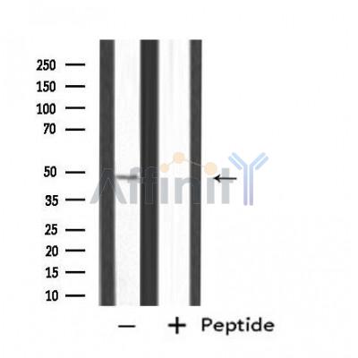 DF4481 staining HeLa cells by IF/ICC. The sample were fixed with PFA and permeabilized in 0.1% Triton X-100,then blocked in 10% serum for 45 minutes at 25¡ãC. The primary antibody was diluted at 1/200 and incubated with the sample for 1 hour at 37¡ãC. An  Alexa Fluor 594 conjugated goat anti-rabbit IgG (H+L) antibody(Cat.# S0006), diluted at 1/600, was used as secondary antibod