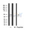 DF4481 staining HeLa cells by IF/ICC. The sample were fixed with PFA and permeabilized in 0.1% Triton X-100,then blocked in 10% serum for 45 minutes at 25¡ãC. The primary antibody was diluted at 1/200 and incubated with the sample for 1 hour at 37¡ãC. An  Alexa Fluor 594 conjugated goat anti-rabbit IgG (H+L) antibody(Cat.# S0006), diluted at 1/600, was used as secondary antibod
