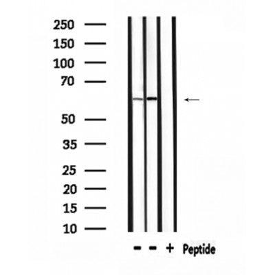 DF4482 staining  HuvEc cells by IF/ICC. The sample were fixed with PFA and permeabilized in 0.1% Triton X-100,then blocked in 10% serum for 45 minutes at 25¡ãC. The primary antibody was diluted at 1/200 and incubated with the sample for 1 hour at 37¡ãC. An  Alexa Fluor 594 conjugated goat anti-rabbit IgG (H+L) antibody(Cat.# S0006), diluted at 1/600, was used as secondary antibod