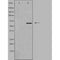 DF4484 at 1/100 staining Human uterus tissue by IHC-P. The sample was formaldehyde fixed and a heat mediated antigen retrieval step in citrate buffer was performed. The sample was then blocked and incubated with the antibody for 1.5 hours at 22¡ãC. An HRP conjugated goat anti-rabbit antibody was used as the secondary