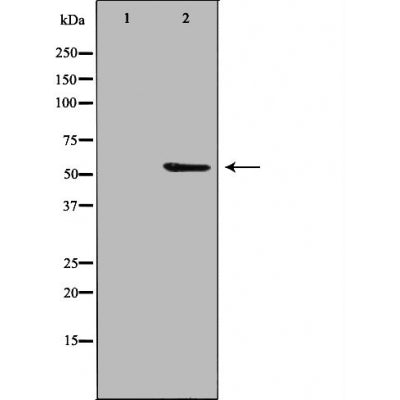 DF4486 staining  HuvEc cells by IF/ICC. The sample were fixed with PFA and permeabilized in 0.1% Triton X-100,then blocked in 10% serum for 45 minutes at 25¡ãC. The primary antibody was diluted at 1/200 and incubated with the sample for 1 hour at 37¡ãC. An  Alexa Fluor 594 conjugated goat anti-rabbit IgG (H+L) antibody(Cat.# S0006), diluted at 1/600, was used as secondary antibod