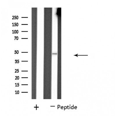 DF4488 staining  Hela cells by IF/ICC. The sample were fixed with PFA and permeabilized in 0.1% Triton X-100,then blocked in 10% serum for 45 minutes at 25¡ãC. The primary antibody was diluted at 1/200 and incubated with the sample for 1 hour at 37¡ãC. An  Alexa Fluor 594 conjugated goat anti-rabbit IgG (H+L) antibody(Cat.# S0006), diluted at 1/600, was used as secondary antibod