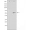 DF4494 at 1/100 staining Human gastric tissue by IHC-P. The sample was formaldehyde fixed and a heat mediated antigen retrieval step in citrate buffer was performed. The sample was then blocked and incubated with the antibody for 1.5 hours at 22¡ãC. An HRP conjugated goat anti-rabbit antibody was used as the secondary
