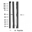 DF4497 staining HepG2 cells by IF/ICC. The sample were fixed with PFA and permeabilized in 0.1% Triton X-100,then blocked in 10% serum for 45 minutes at 25¡ãC. The primary antibody was diluted at 1/200 and incubated with the sample for 1 hour at 37¡ãC. An  Alexa Fluor 594 conjugated goat anti-rabbit IgG (H+L) antibody(Cat.