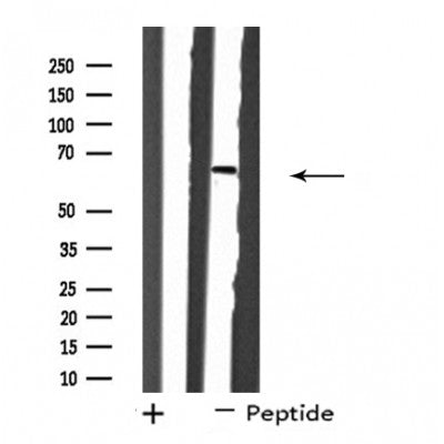 DF4499 staining HuvEc cells by IF/ICC. The sample were fixed with PFA and permeabilized in 0.1% Triton X-100,then blocked in 10% serum for 45 minutes at 25¡ãC. The primary antibody was diluted at 1/200 and incubated with the sample for 1 hour at 37¡ãC. An  Alexa Fluor 594 conjugated goat anti-rabbit IgG (H+L) antibody(Cat.# S0006), diluted at 1/600, was used as secondary antibod