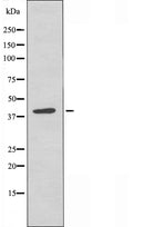 DF4500 staining Hela by IF/ICC. The sample were fixed with PFA and permeabilized in 0.1% Triton X-100,then blocked in 10% serum for 45 minutes at 25¡ãC. The primary antibody was diluted at 1/200 and incubated with the sample for 1 hour at 37¡ãC. An  Alexa Fluor 594 conjugated goat anti-rabbit IgG (H+L) Ab, diluted at 1/600, was used as the secondary antibod