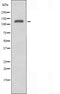 DF4502 staining Hela by IF/ICC. The sample were fixed with PFA and permeabilized in 0.1% Triton X-100,then blocked in 10% serum for 45 minutes at 25¡ãC. The primary antibody was diluted at 1/200 and incubated with the sample for 1 hour at 37¡ãC. An  Alexa Fluor 594 conjugated goat anti-rabbit IgG (H+L) Ab, diluted at 1/600, was used as the secondary antibod