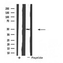 DF4503 at 1/100 staining Mouse lung tissue by IHC-P. The sample was formaldehyde fixed and a heat mediated antigen retrieval step in citrate buffer was performed. The sample was then blocked and incubated with the antibody for 1.5 hours at 22¡ãC. An HRP conjugated goat anti-rabbit antibody was used as the secondary