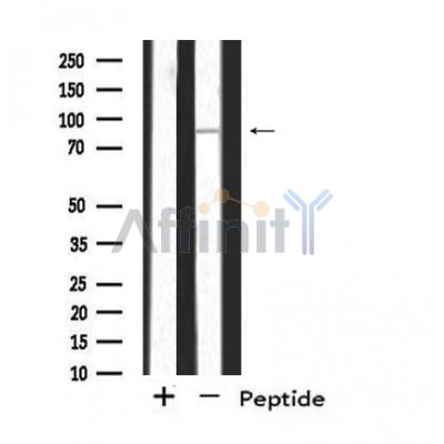 Western blot analysis of extracts from Mouse  muscle, using SH3RF3 Antibody. The lane on the left was treated with blocking peptide.