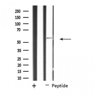 DF4506 staining Hela cells by IF/ICC. The sample were fixed with PFA and permeabilized in 0.1% Triton X-100,then blocked in 10% serum for 45 minutes at 25¡ãC. The primary antibody was diluted at 1/200 and incubated with the sample for 1 hour at 37¡ãC. An  Alexa Fluor 594 conjugated goat anti-rabbit IgG (H+L) antibody(Cat.# S0006), diluted at 1/600, was used as secondary antibod