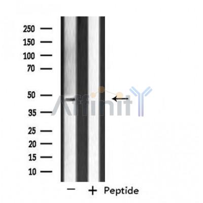 DF4507 staining HeLa by IF/ICC. The sample were fixed with PFA and permeabilized in 0.1% Triton X-100,then blocked in 10% serum for 45 minutes at 25¡ãC. The primary antibody was diluted at 1/200 and incubated with the sample for 1 hour at 37¡ãC. An  Alexa Fluor 594 conjugated goat anti-rabbit IgG (H+L) Ab, diluted at 1/600, was used as the secondary antibod